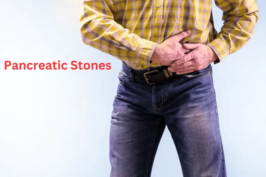 Pancreatic Stones: A Comprehensive Guide to Detection and Intervention Pancreatic Stones