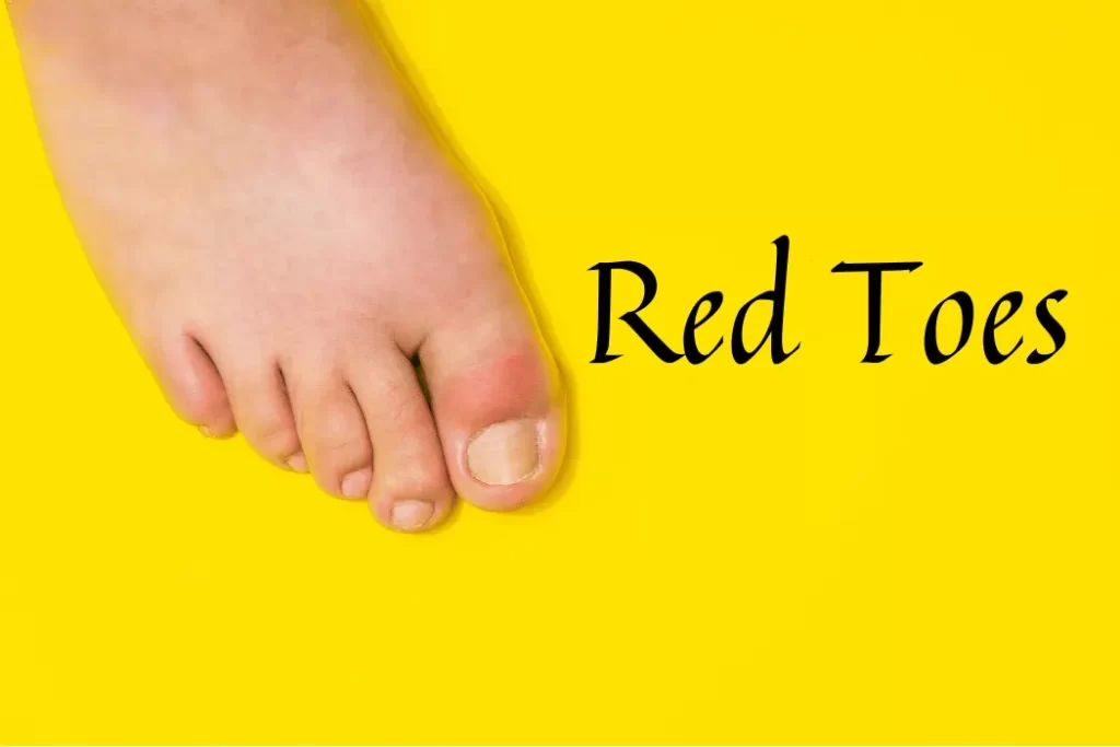 Red Toes