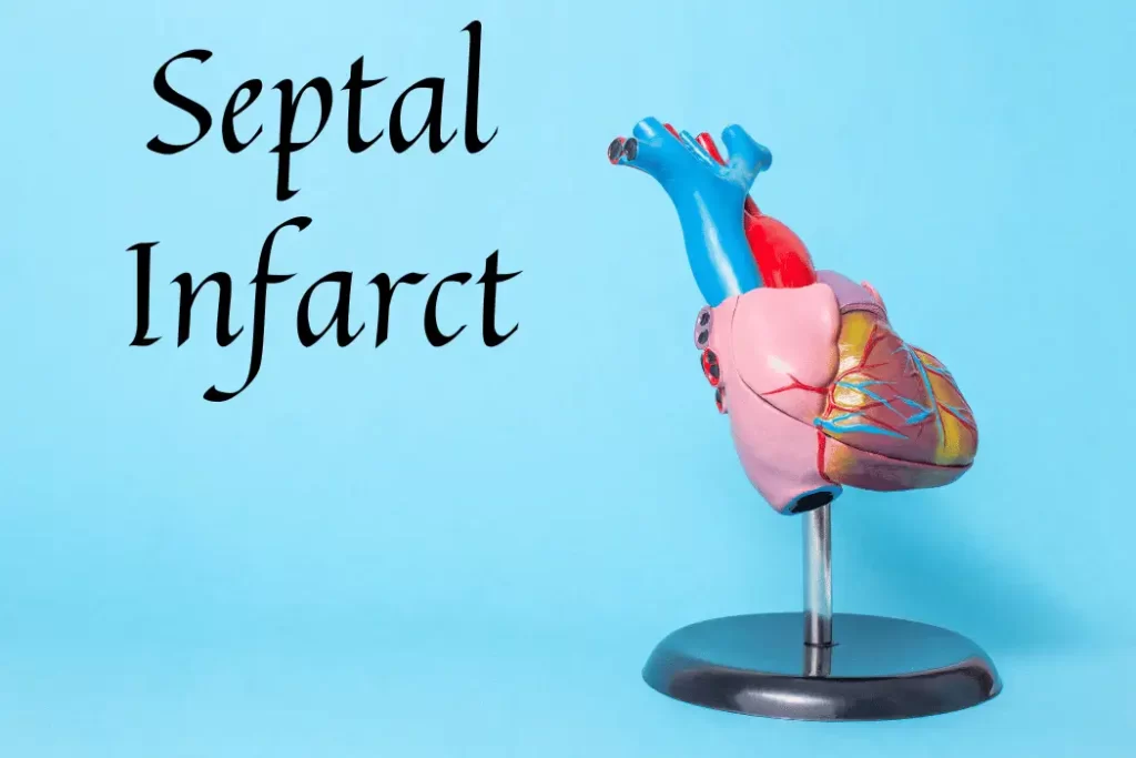 Septal Infarct 2